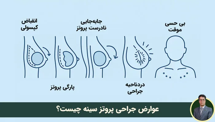 آیا جراحی پروتز پستان عوارض دارد؟