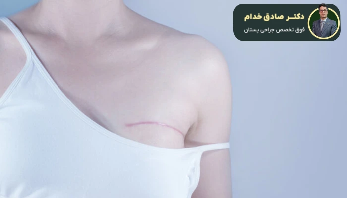 مراحل انجام جراحی بازسازی پستان