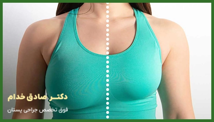 بهترین جراح لیفت سینه در کرمان